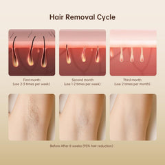 Home laser hair removal device for permanent body and facial hair reduction with safe and effective laser technology