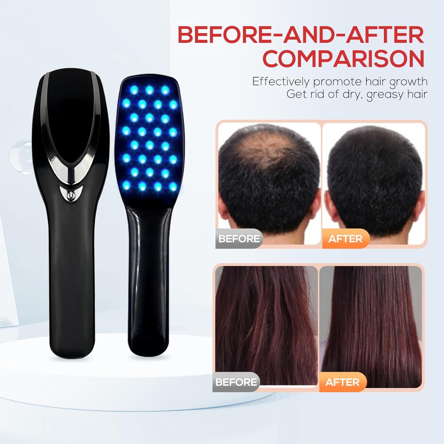 Professional-grade laser comb for hair restoration, offering a non-invasive alternative for treating hair loss